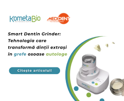 Smart Dentin Grinder: Tehnologia care transformă dinții extrași în grefe osoase autologe