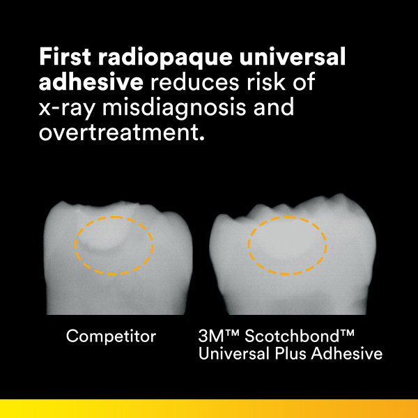 Radiopac Universal Adhesive