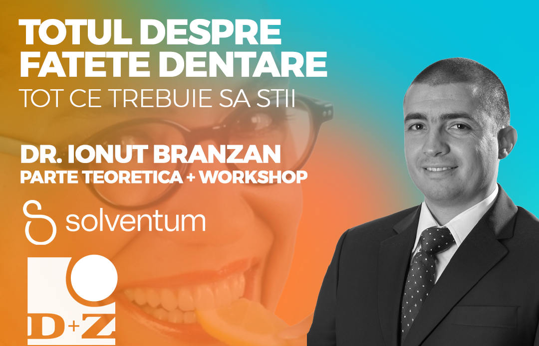 Totul despre fatetele dentare