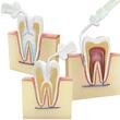 Varfuri aplicatoare elastice Applicators 25G Long Bent Cerkamed 