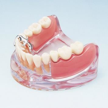 Model de studiu PE-IMP002 Nissin